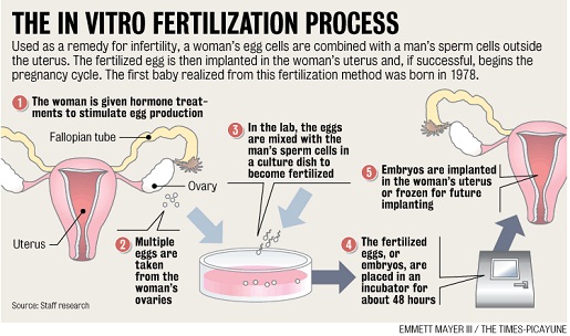 diagram of in vitro fertilization