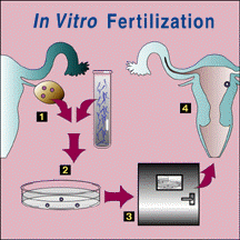 in vitro fertilization diagram