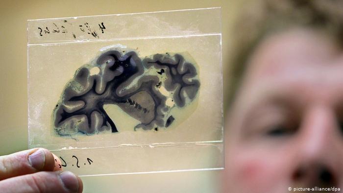brain specimen from Holocaust
          victim